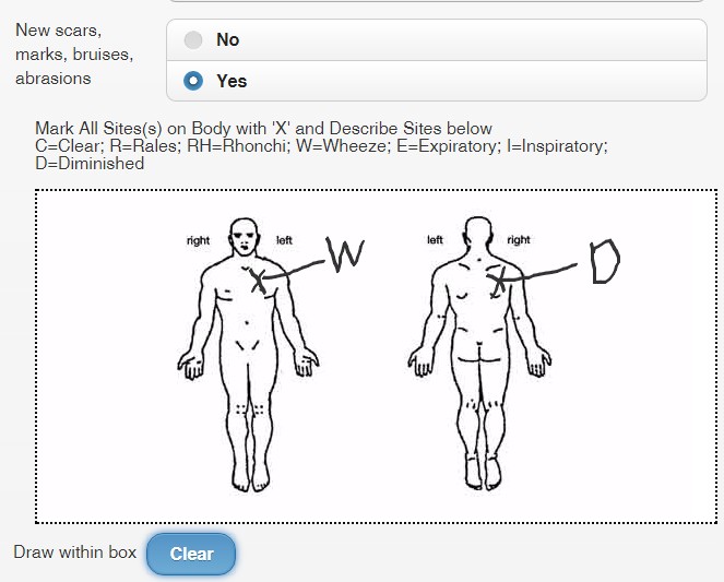 Annotations